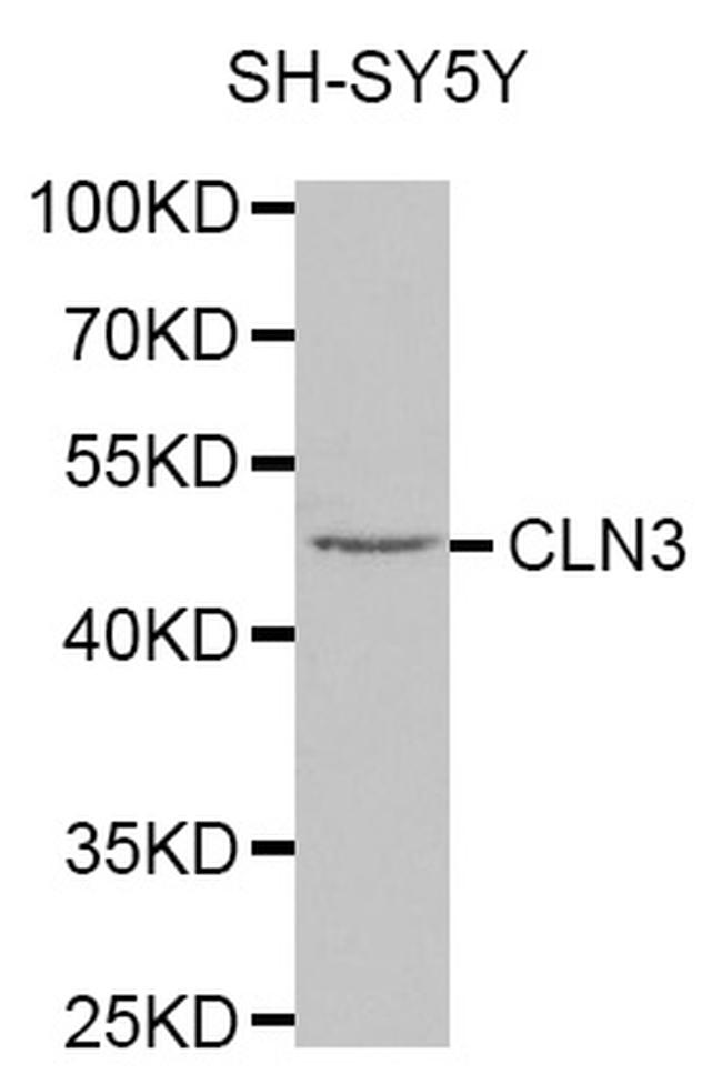 CLN3 Antibody in Western Blot (WB)