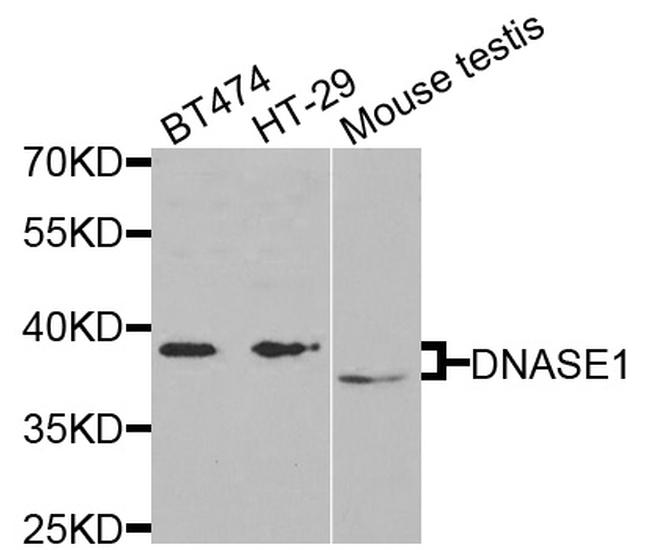 DNase I Antibody in Western Blot (WB)