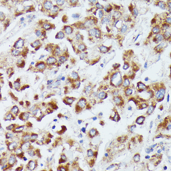 DUT Antibody in Immunohistochemistry (Paraffin) (IHC (P))