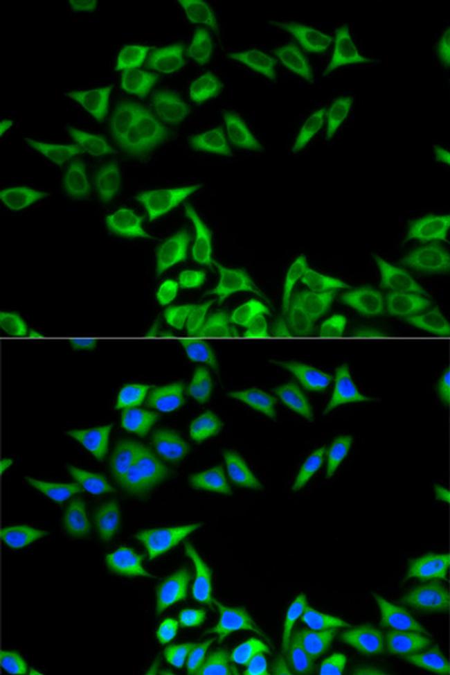 CHMP2B Antibody in Immunocytochemistry (ICC/IF)