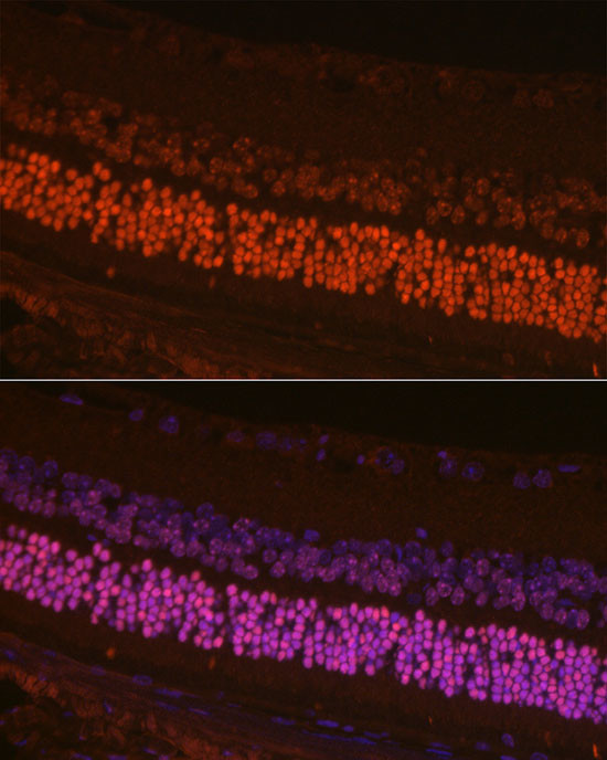 CRX Antibody in Immunocytochemistry (ICC/IF)