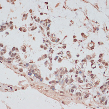 PRPF31 Antibody in Immunohistochemistry (Paraffin) (IHC (P))