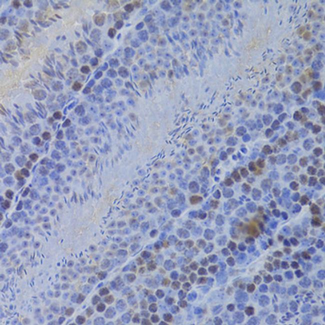 HELLS Antibody in Immunohistochemistry (Paraffin) (IHC (P))