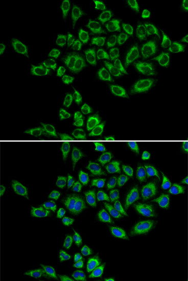 SRPK1 Antibody in Immunocytochemistry (ICC/IF)