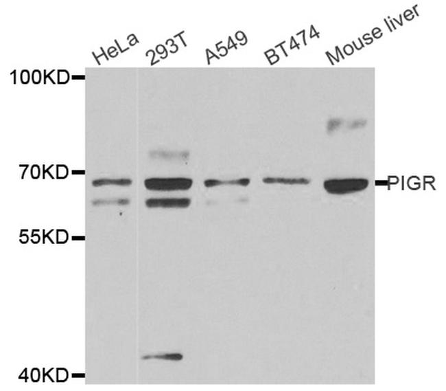 PIGR Antibody in Western Blot (WB)