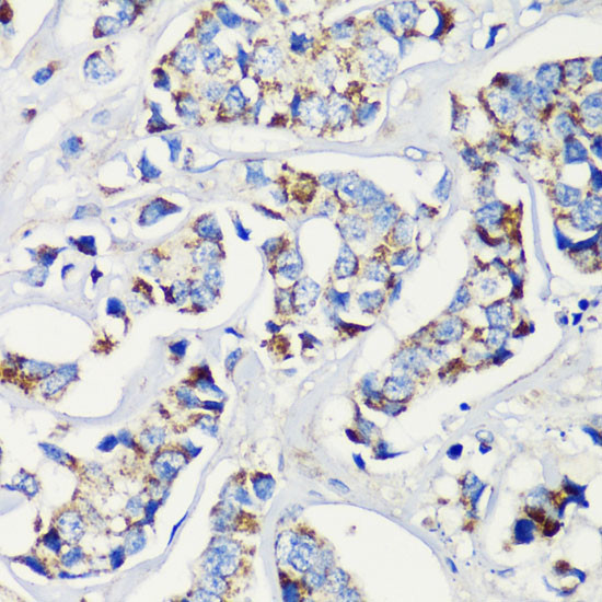 KMT2E Antibody in Immunohistochemistry (Paraffin) (IHC (P))