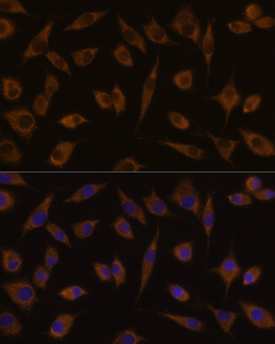 UGT1A1 Antibody in Immunocytochemistry (ICC/IF)