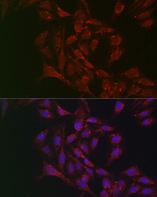 ATGL Antibody in Immunocytochemistry (ICC/IF)