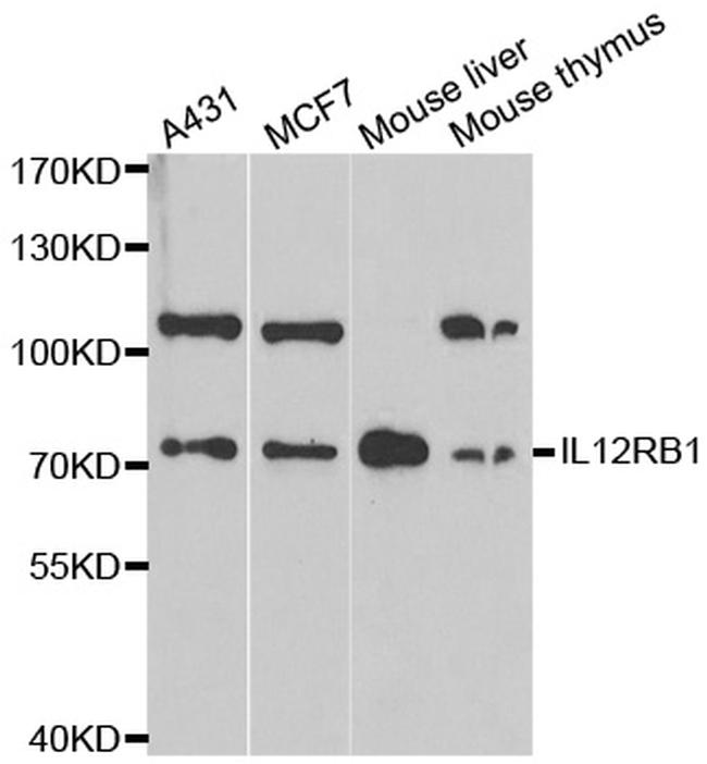 IL12RB1 Antibody in Western Blot (WB)