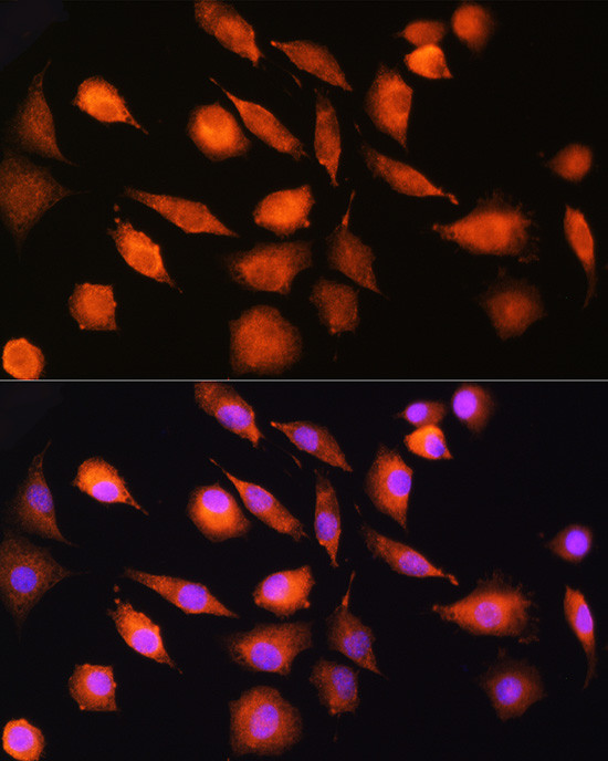 EXT2 Antibody in Immunocytochemistry (ICC/IF)