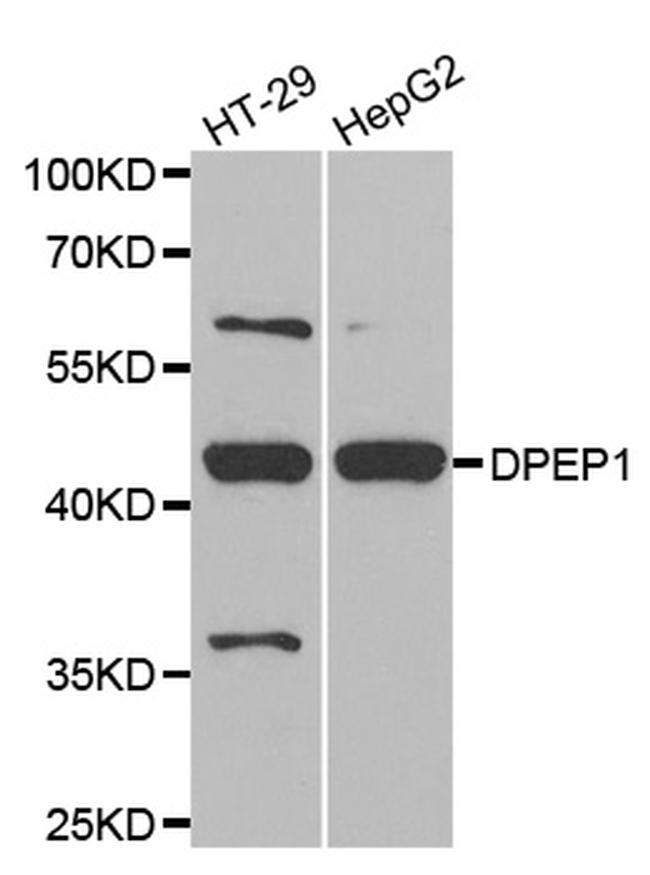 DPEP1 Antibody in Western Blot (WB)