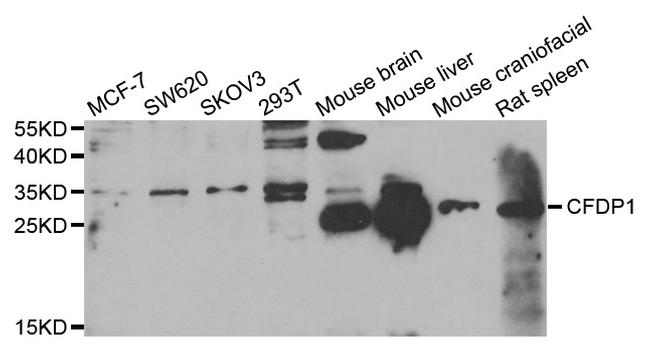 CFDP1 Antibody in Western Blot (WB)