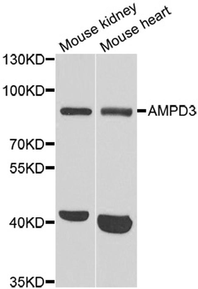 AMPD3 Antibody in Western Blot (WB)