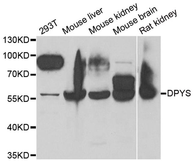 DPYS Antibody in Western Blot (WB)