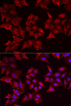 PCBD1 Antibody in Immunocytochemistry (ICC/IF)