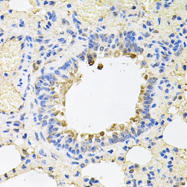 SKAP2 Antibody in Immunohistochemistry (Paraffin) (IHC (P))