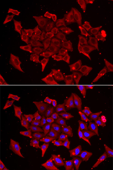 TIM17 Antibody in Immunocytochemistry (ICC/IF)