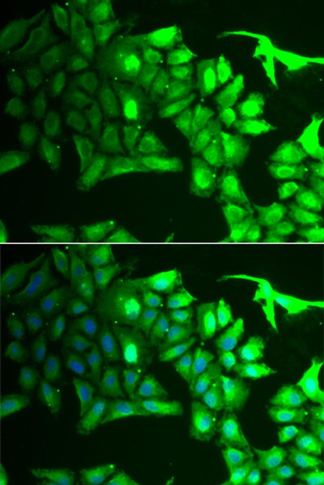 AIPL1 Antibody in Immunocytochemistry (ICC/IF)