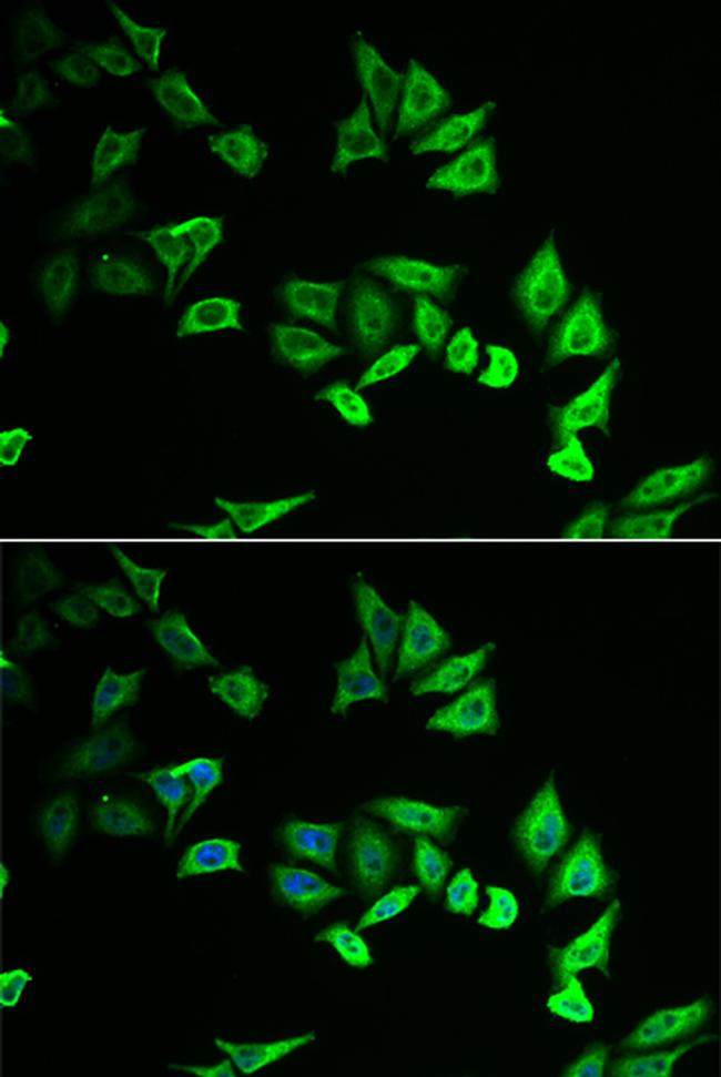 MYOZ2 Antibody in Immunocytochemistry (ICC/IF)