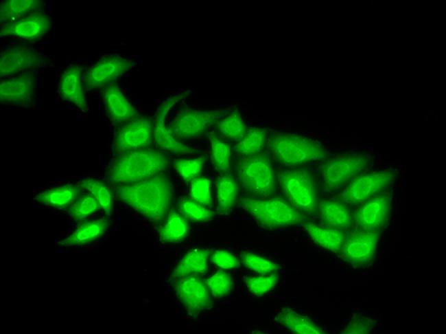 POLE3 Antibody in Immunocytochemistry (ICC/IF)