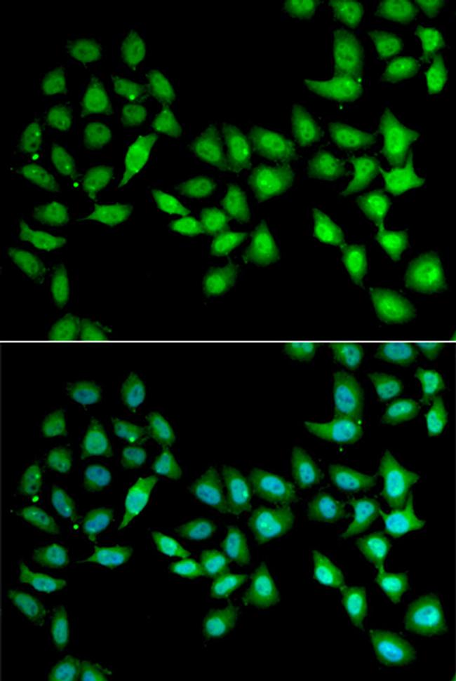 UCN2 Antibody in Immunocytochemistry (ICC/IF)