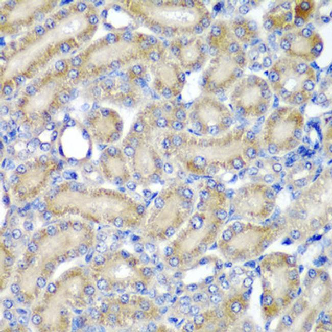 PDCD6 Antibody in Immunohistochemistry (Paraffin) (IHC (P))