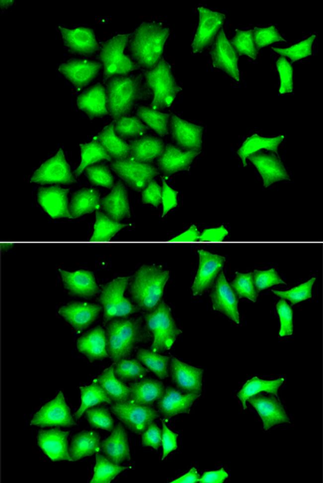 MSRB1 Antibody in Immunocytochemistry (ICC/IF)