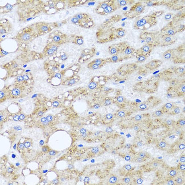 Sorcin Antibody in Immunohistochemistry (Paraffin) (IHC (P))