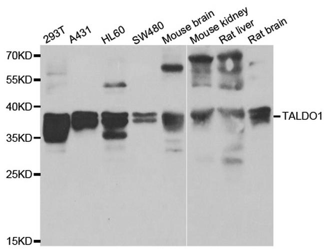 TALDO1 Antibody in Western Blot (WB)