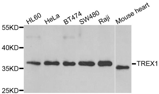 TREX1 Antibody in Western Blot (WB)