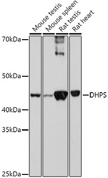 DHPS Antibody in Western Blot (WB)