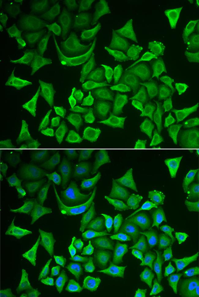 DTYMK Antibody in Immunocytochemistry (ICC/IF)