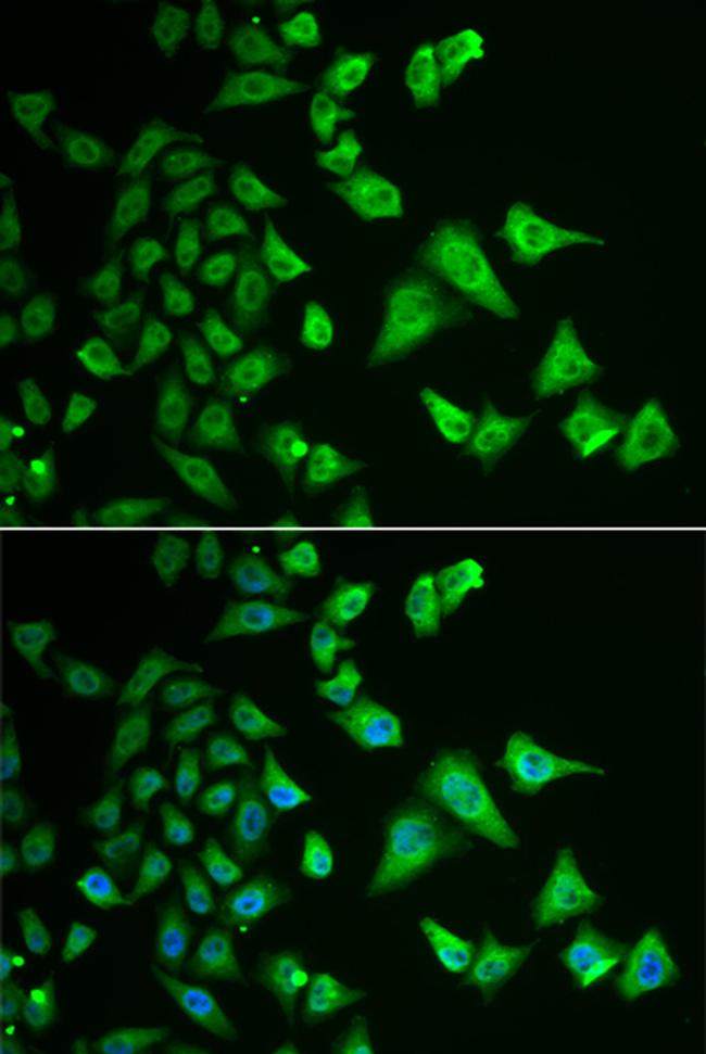 DHRS2 Antibody in Immunocytochemistry (ICC/IF)