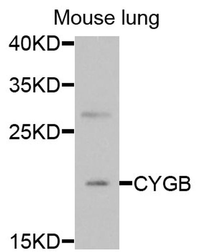 Cytoglobin Antibody in Immunocytochemistry (ICC/IF)