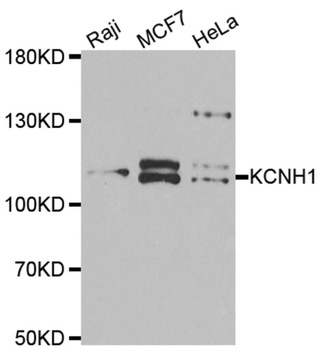 KCNH1 Antibody in Western Blot (WB)