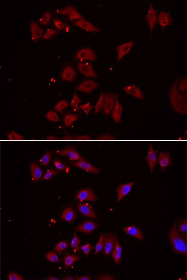 NPHP1 Antibody in Immunocytochemistry (ICC/IF)