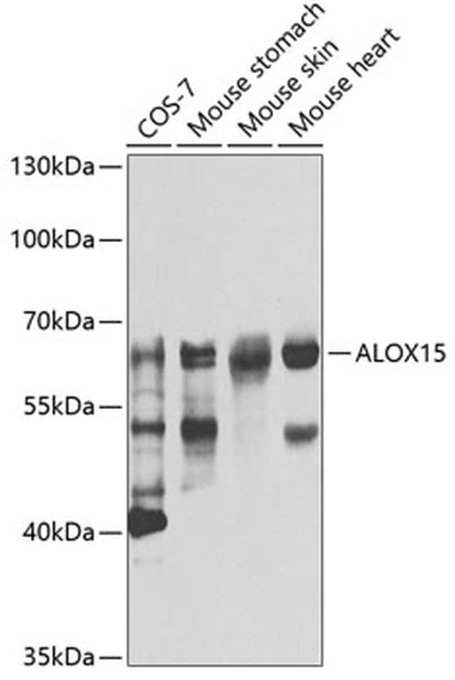 ALOX15 Antibody in Western Blot (WB)