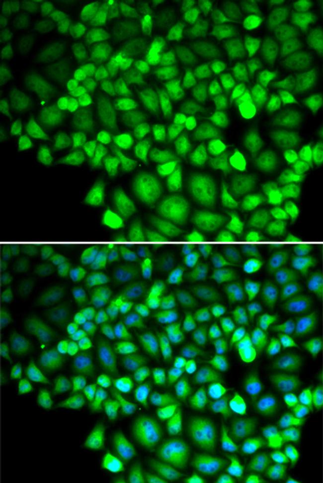 ALOX15B Antibody in Immunocytochemistry (ICC/IF)