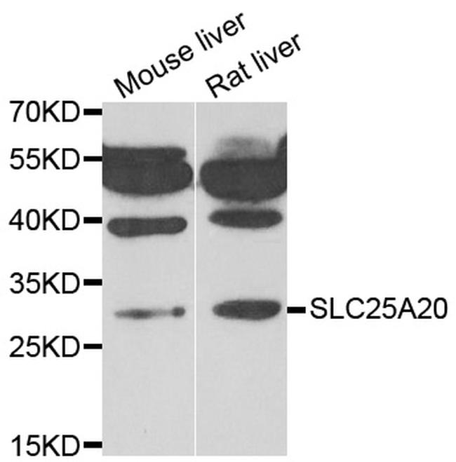 SLC25A20 Antibody in Western Blot (WB)