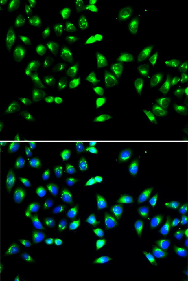 GALNT2 Antibody in Immunocytochemistry (ICC/IF)