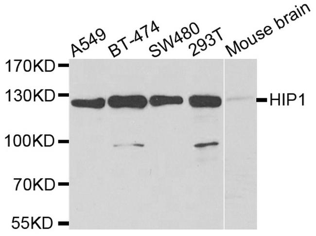 HIP1 Antibody in Western Blot (WB)