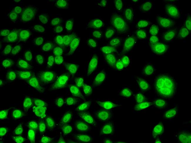 Periplakin Antibody in Immunocytochemistry (ICC/IF)