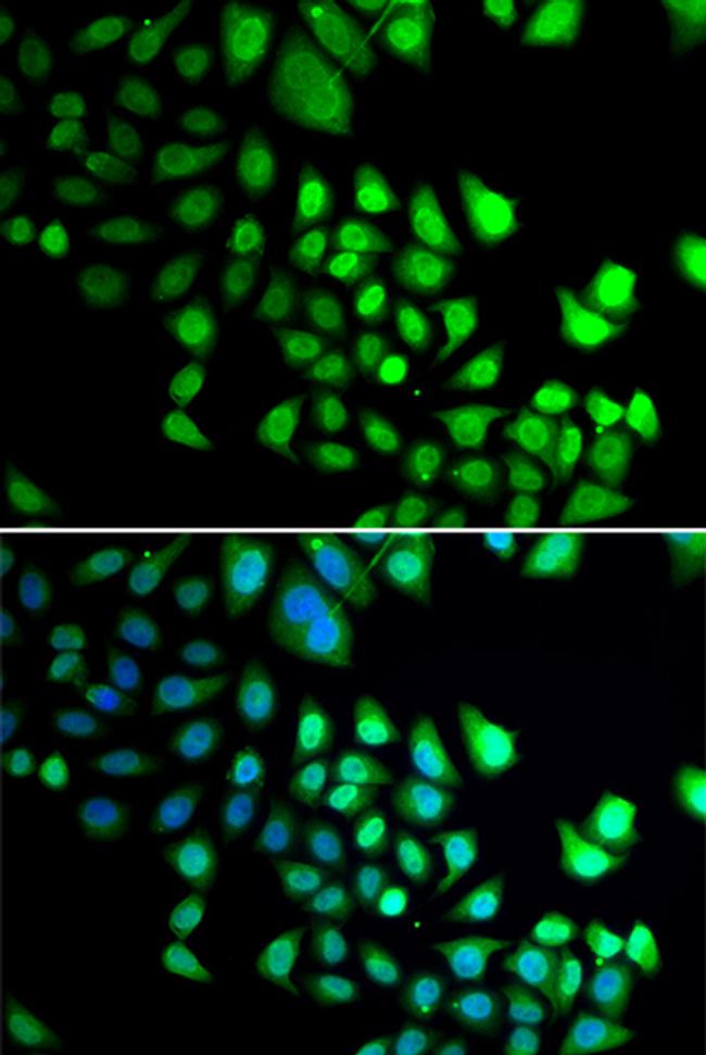 RBBP5 Antibody in Immunocytochemistry (ICC/IF)