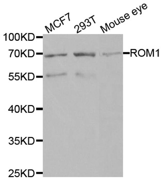 ROM1 Antibody in Western Blot (WB)