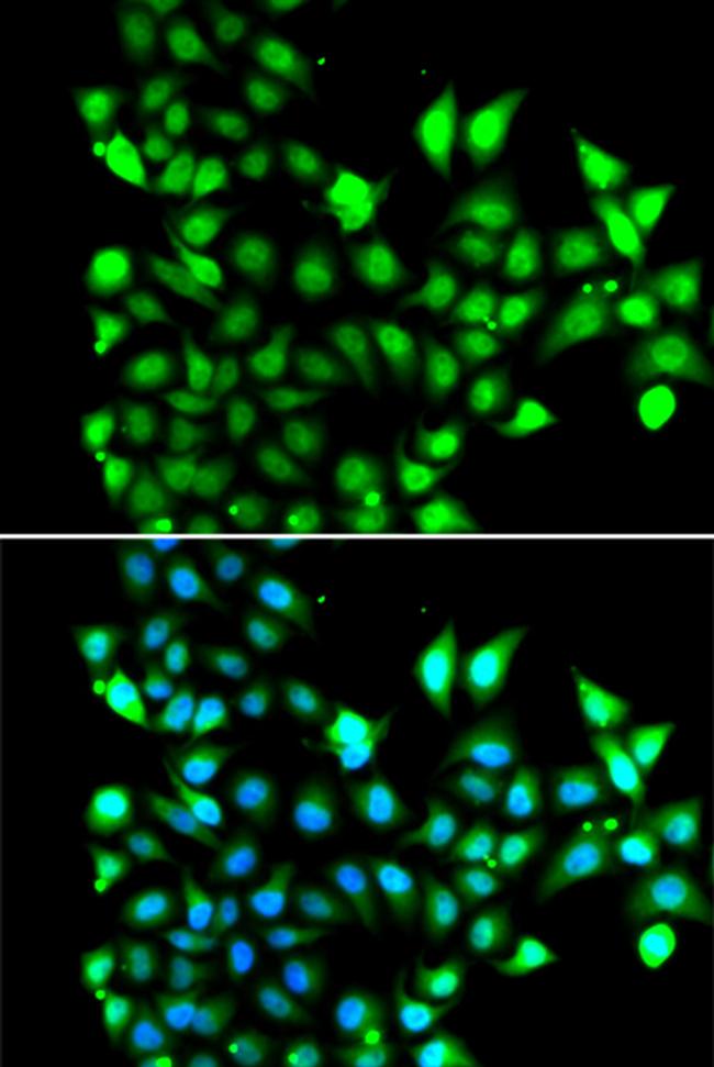 SNRPD2 Antibody in Immunocytochemistry (ICC/IF)