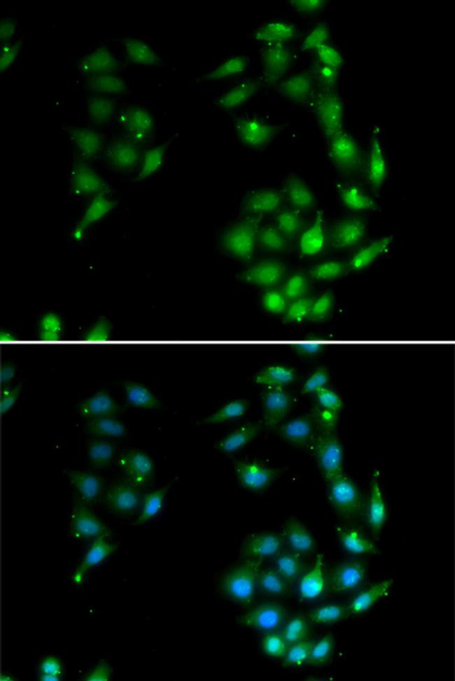 SOX5 Antibody in Immunocytochemistry (ICC/IF)