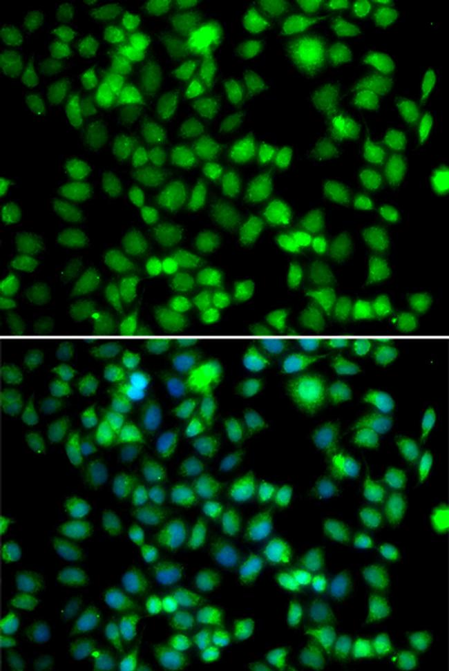 FKBP6 Antibody in Immunocytochemistry (ICC/IF)