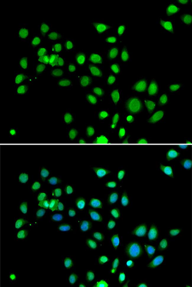 Histone Macro-H2A.1 Antibody in Immunocytochemistry (ICC/IF)