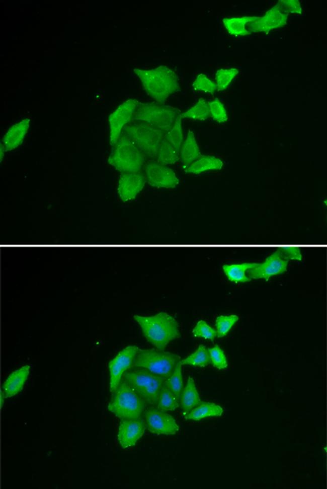 TUSC2 Antibody in Immunocytochemistry (ICC/IF)