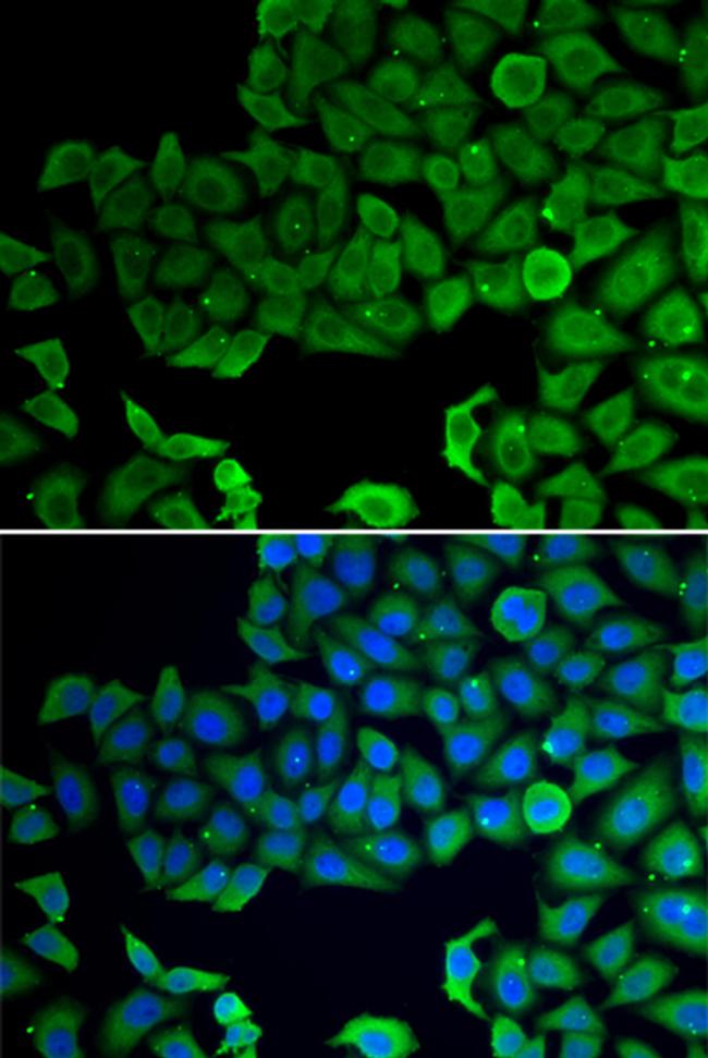 VPS4A Antibody in Immunocytochemistry (ICC/IF)